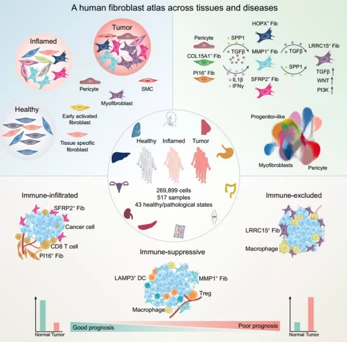 Single-cell atlas maps fibroblast states—healthy, inflamed, tumor—and immune contexts (infiltrated, suppressive, excluded) linked to patient prognosis.
